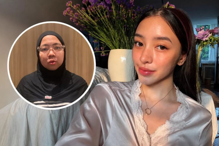 Kronologi Kasus Dokter Kecantikan ERHA yang Body Shaming Amanda Zahra Viral, Kini Sampaikan Permintaan Maaf!